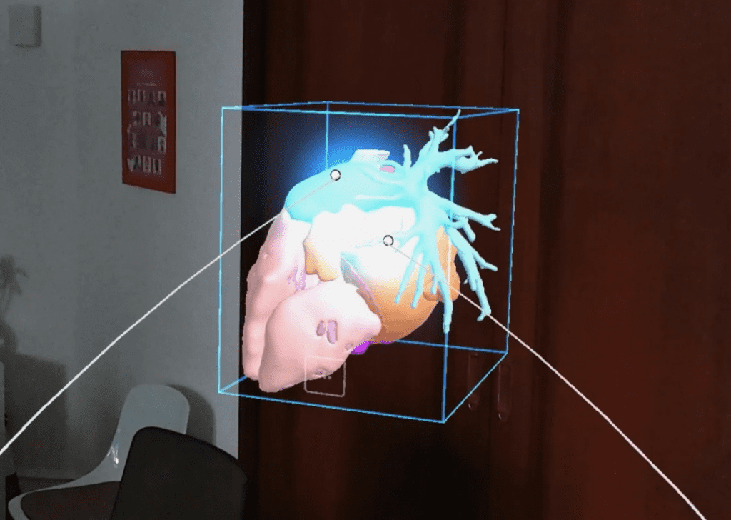 Manipulation d'organe en 3D